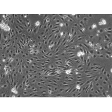 Porcine Pulmonary Microvascular Endothelial Cells (PPMEC)